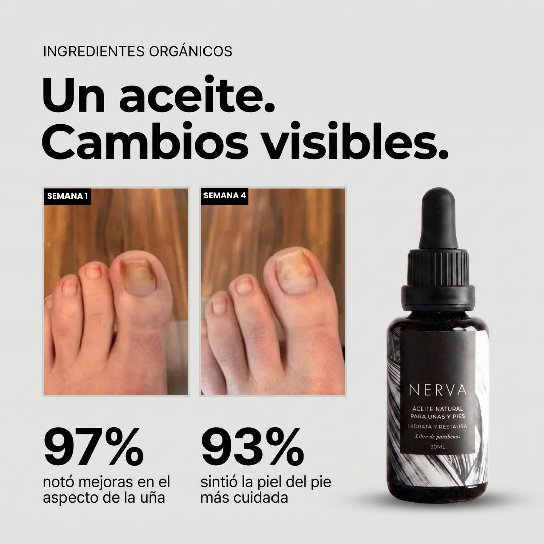 Aceite antihongos para uñas de pies