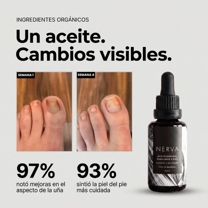 Aceite antihongos para uñas de pies