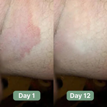 Crema Corporal Antifúngica - NERVA