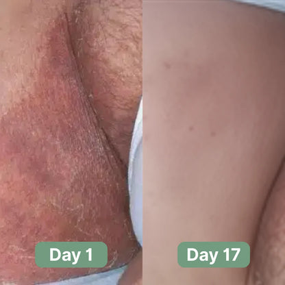 Crema Corporal Antifúngica - NERVA